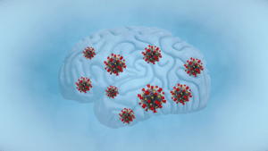 Covid Brain Smaller 300x169 Covid Brain Smaller 300x169