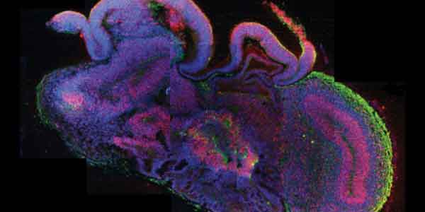 Organoid Cropped Organoid Cropped